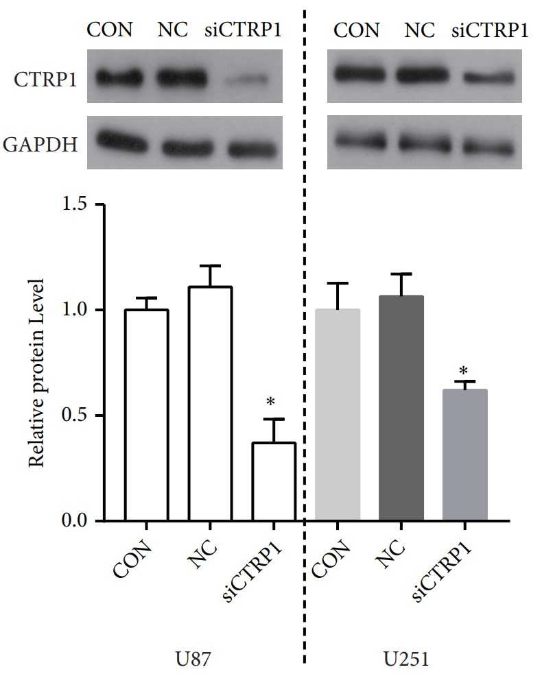 The expressions of CTRP1.jpg